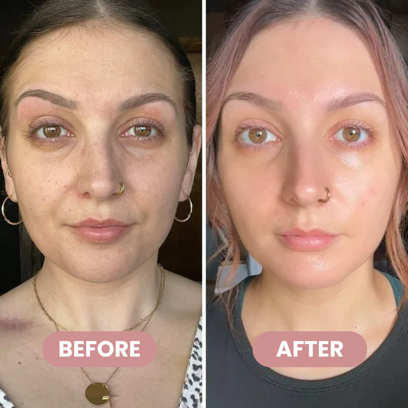 SEVULI® PDRN+Collagen Multi Balm