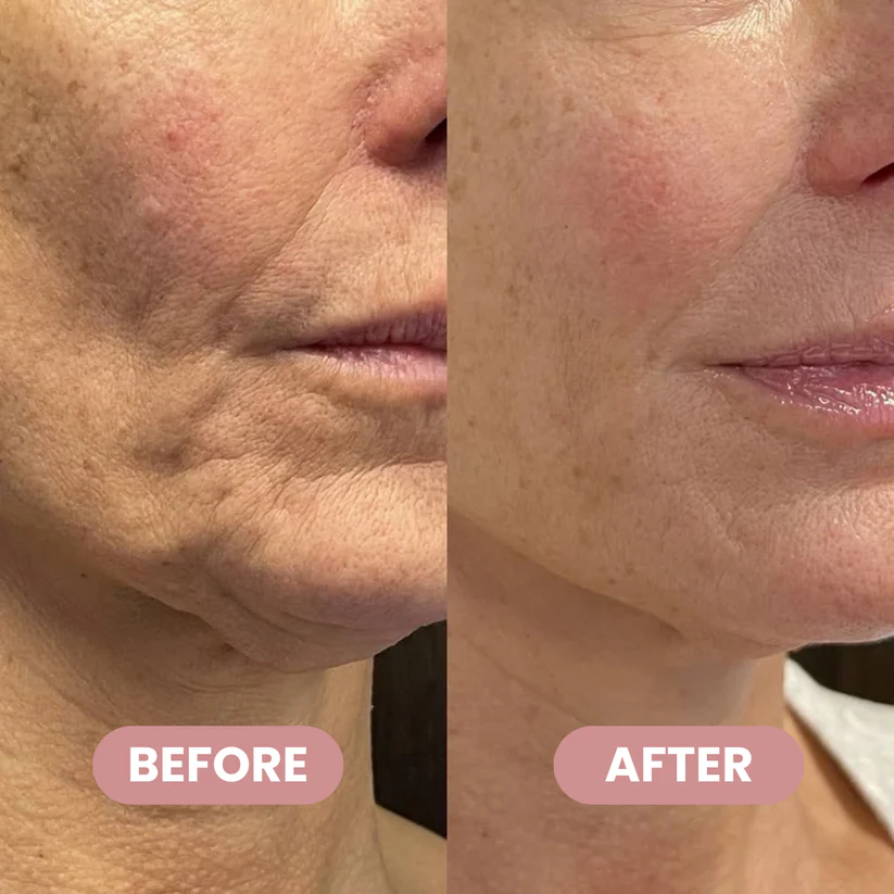 SEVULI® PDRN+Collagen Multi Balm