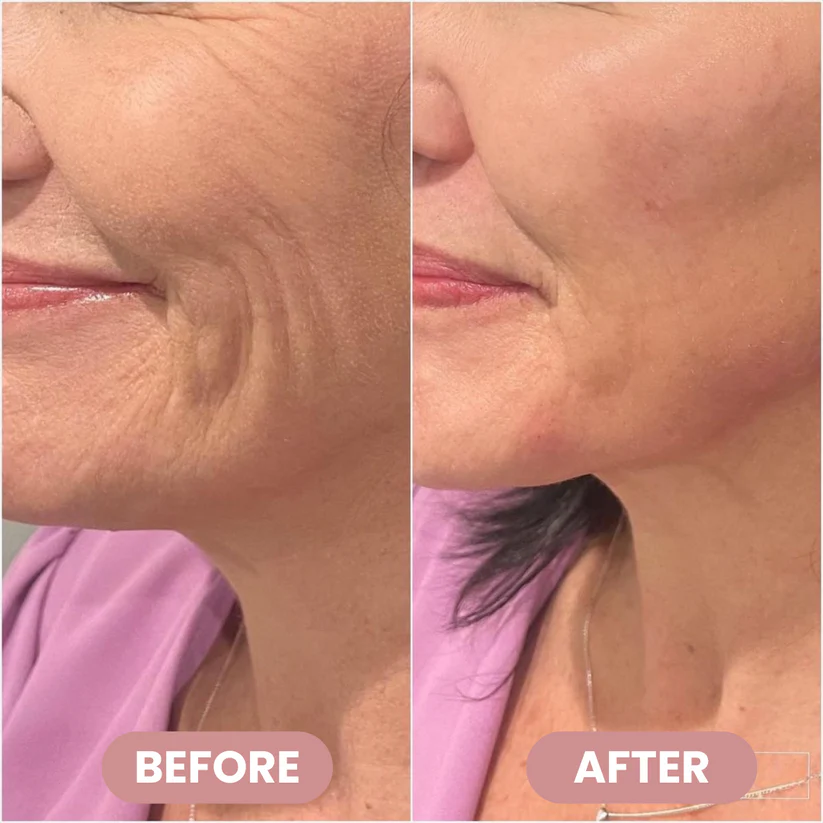 SEVULI® PDRN+Collagen Multi Balm